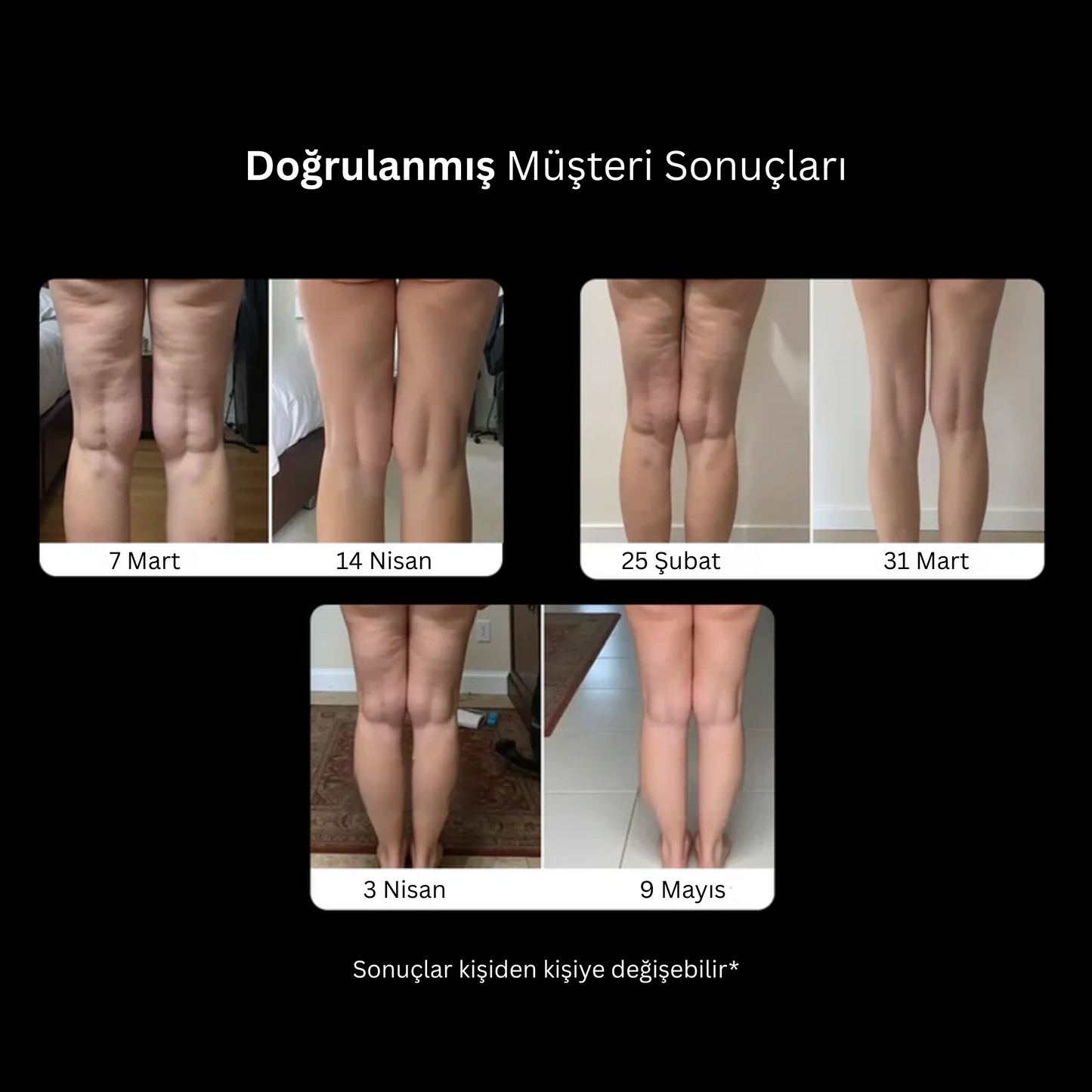 Selülit Karşıtı Kompresyon TightTonic™