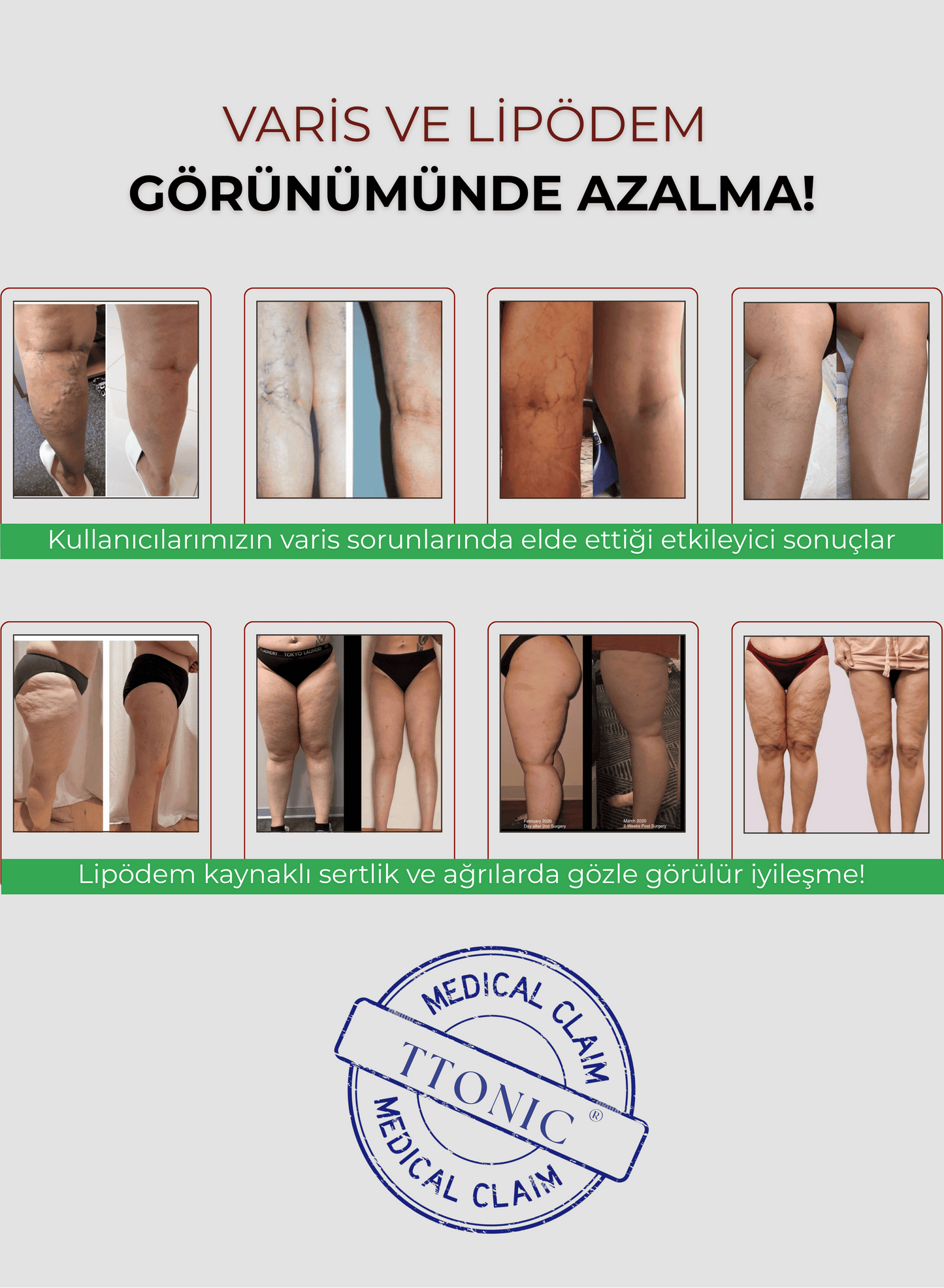 3'lü Etki Taytı Selülit, Varis, Lipödem TightTonic™