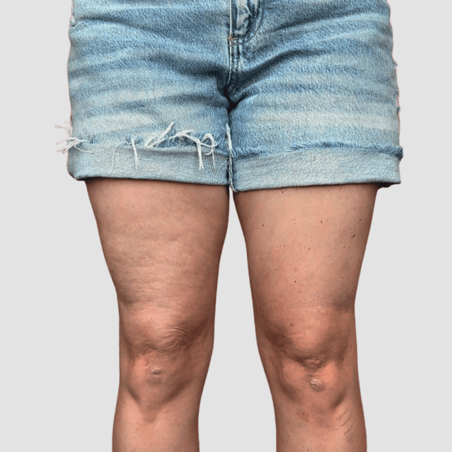 Gizli Vücut Gerdirme Bandı TightTonic™ - Tight Tonic