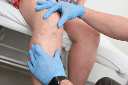 Bacaklarda Ağırlık Hissi Normal Değil: Bilmeniz Gerekenler - Tight Tonic