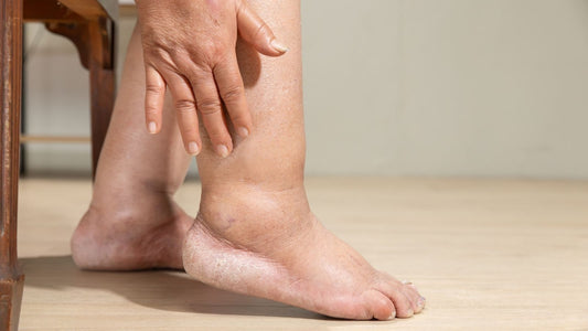 Her Sabah Aynı Şey: Şiş, Ağrılı, Yorulmuş Bacaklar… - Tight Tonic