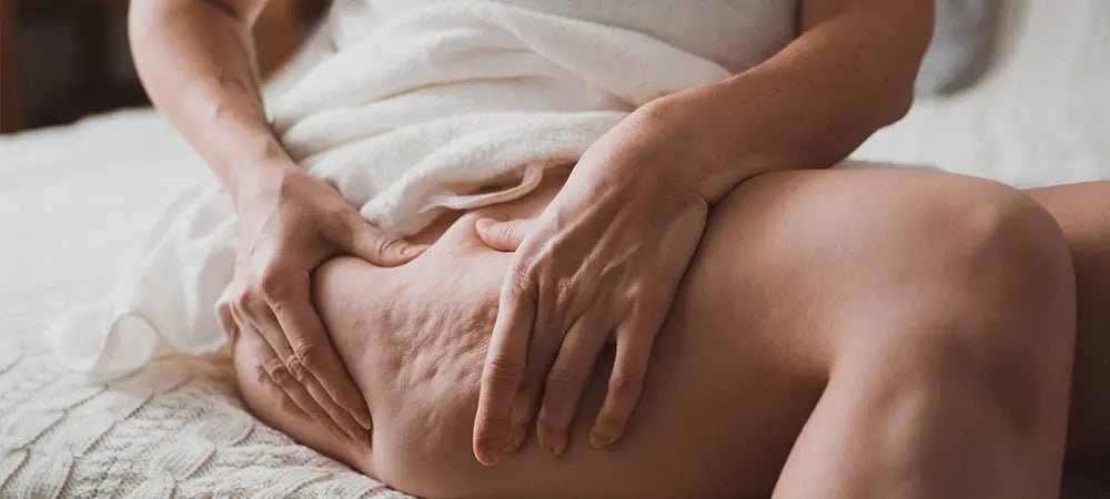 Selülit Görünümünü Azaltmak Mümkün mü? Gerçekler, Yöntemler ve Etkili Destekler - Tight Tonic