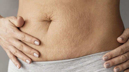 Selülit, Varis, Sarkma… Aynaya Her Bakışımda Bir Neden Daha Eksiliyordu - Tight Tonic