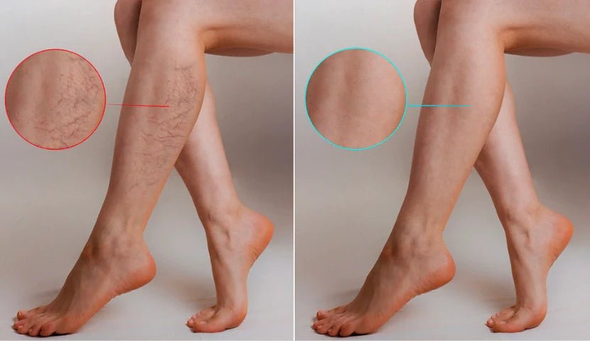 Varis Oluşumunu Engelleyen 7 Öneri - Tight Tonic