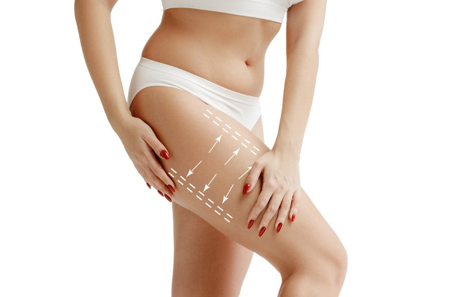 Selülit, Lipödem ve Varis Önleyici