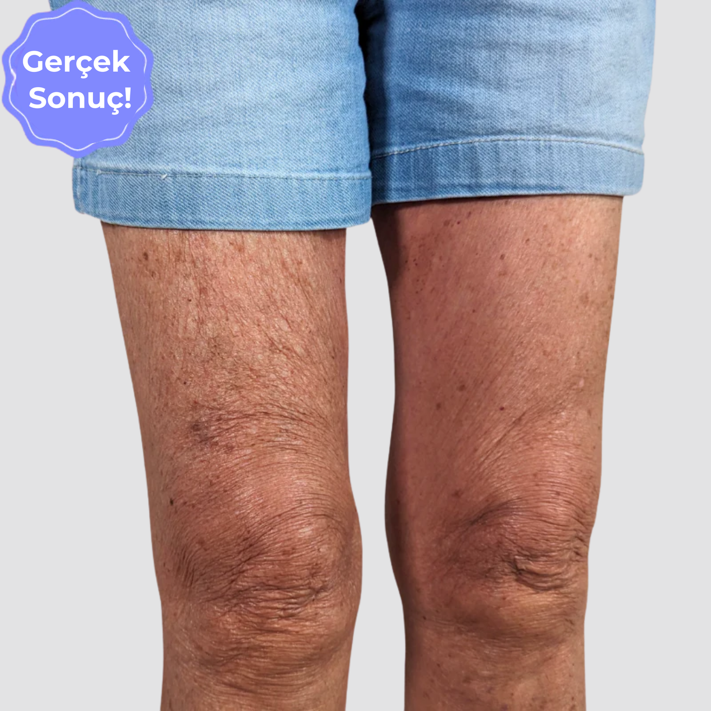 Gizli Vücut Gerdirme Bandı TightTonic™