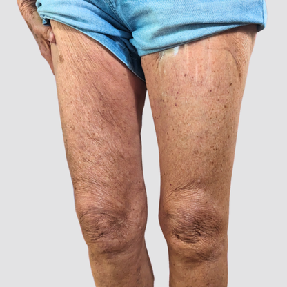 Gizli Vücut Gerdirme Bandı TightTonic™