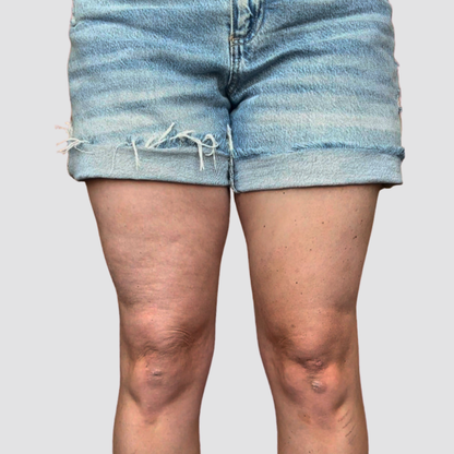 Gizli Vücut Gerdirme Bandı TightTonic™