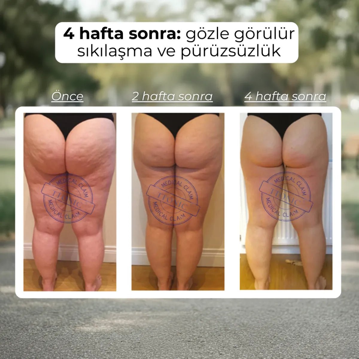 3D Toparlayıcı Anti - Selülit Şort - Tight Tonic