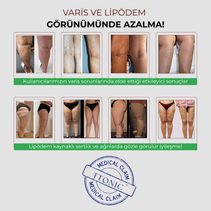 3’lü Etki Cepli Tayt Selülit, Varis, Lipödem TightTonic™ - Tight Tonic