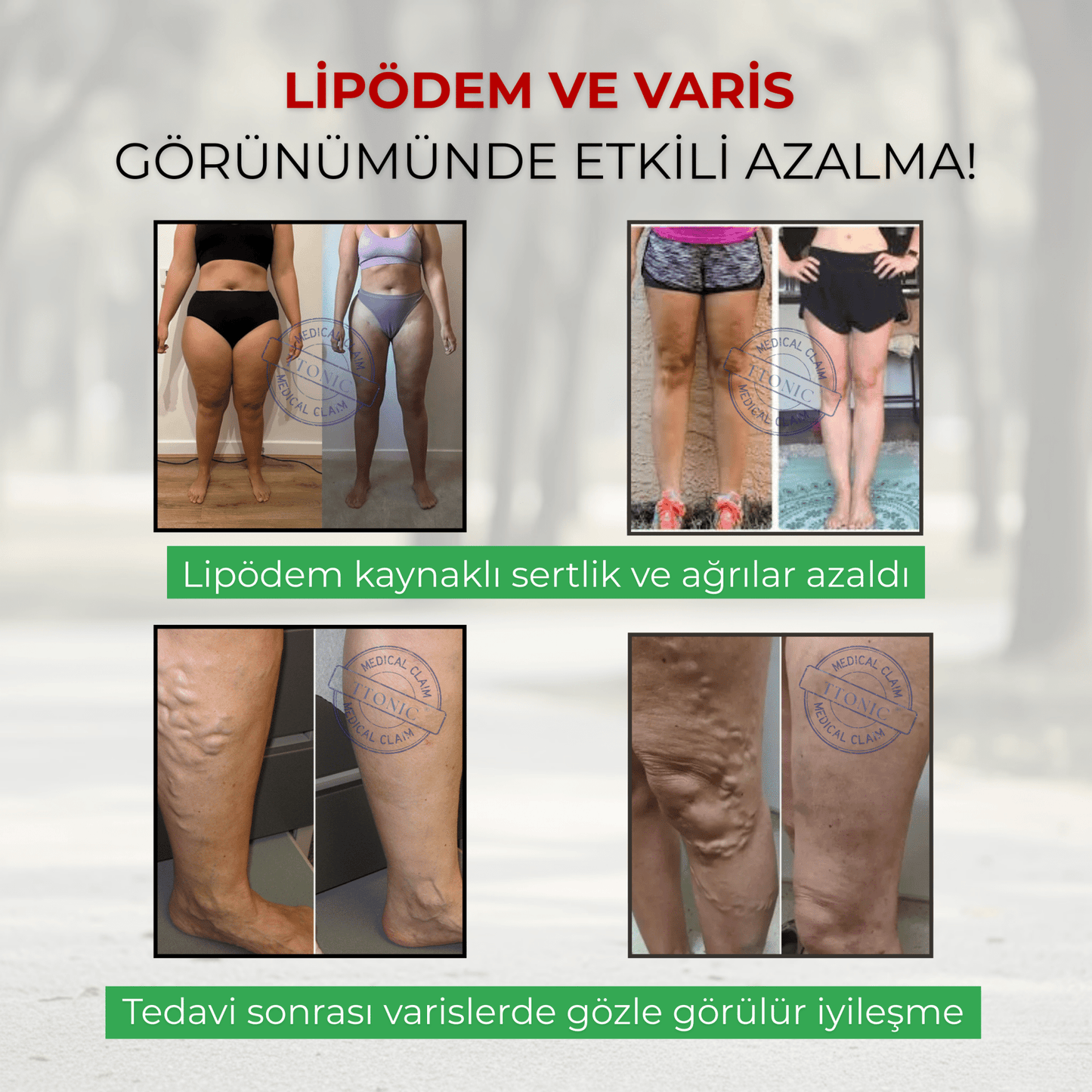 3'lü Etki Taytı Lipödem, Selülit, Varis - Tight Tonic