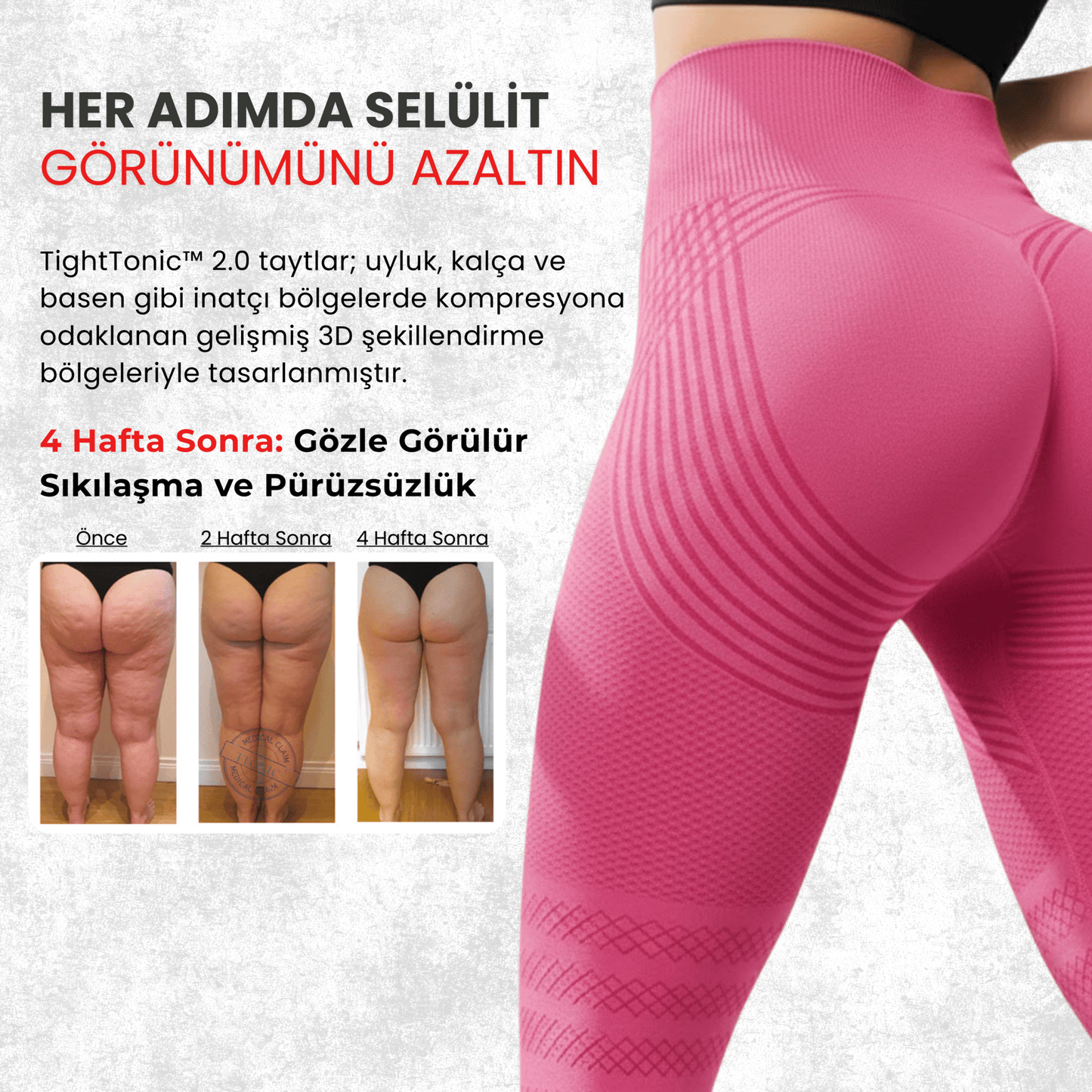 3'lü Etki Taytı Lipödem, Selülit, Varis - Tight Tonic