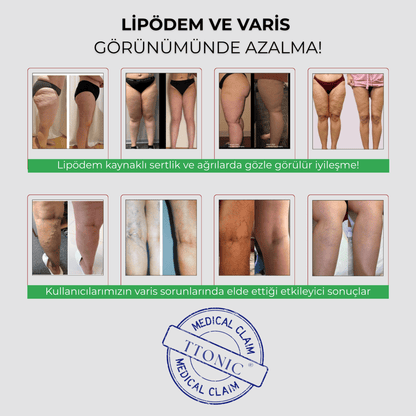 Anti - Selülit Konfor Taytı TightTonic™ - Tight Tonic