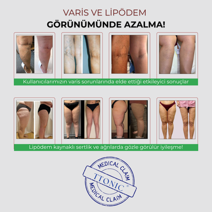 Anti-Selülit Konfor Taytı TightTonic™