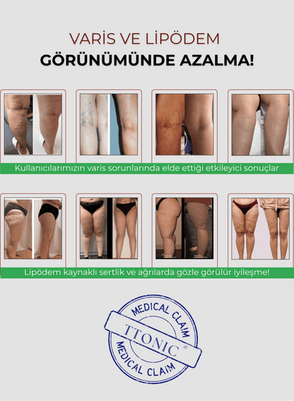 3'lü Etki Taytı Selülit, Varis, Lipödem TightTonic™
