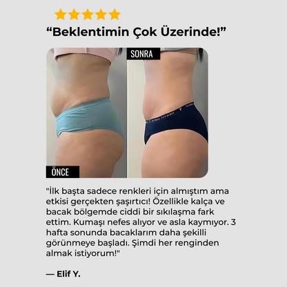 Anti-Selülit Konfor Taytı TightTonic™