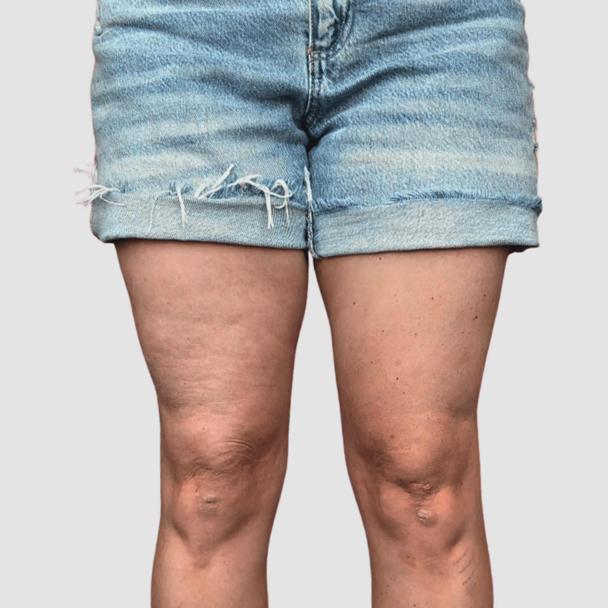 Gizli Vücut Gerdirme Bandı TightTonic™ - Tight Tonic