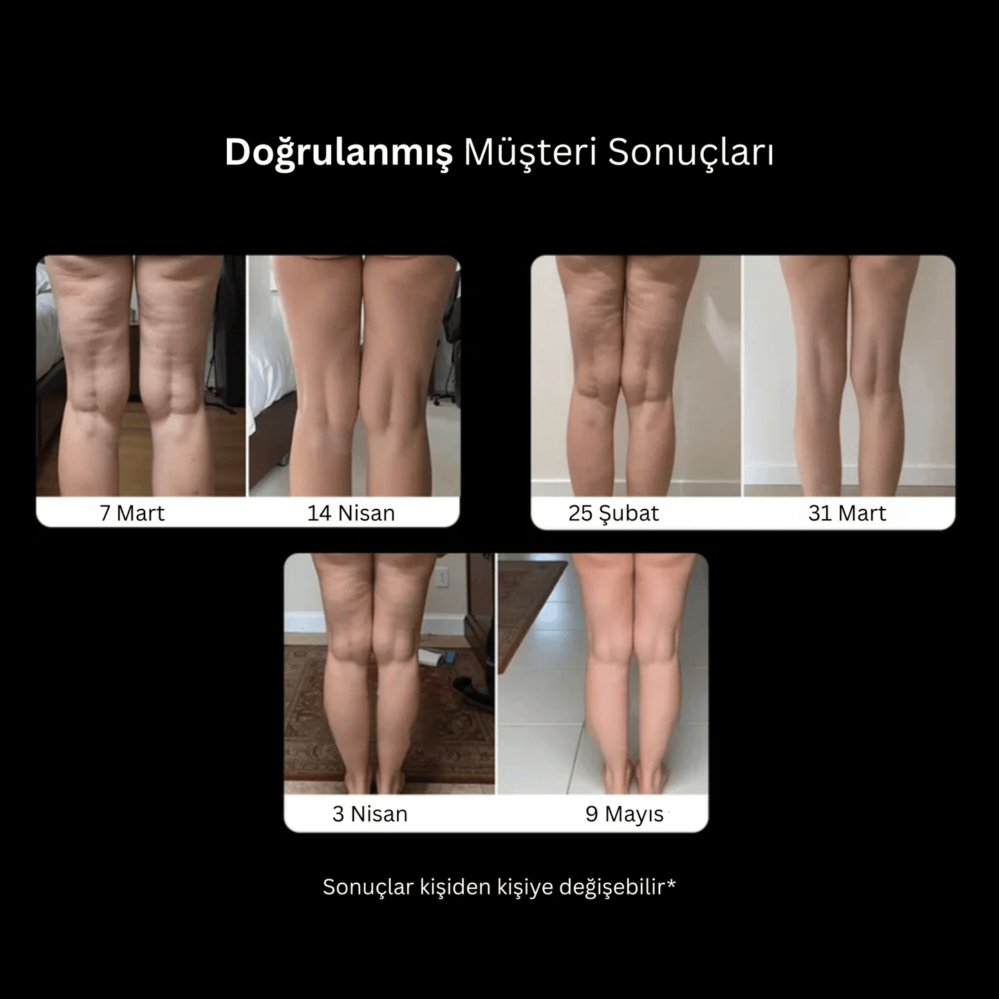 Selülit Karşıtı Kompresyon TightTonic™ - Tight Tonic